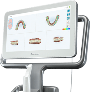 iTero iSmile Orthodontics Seattle WA