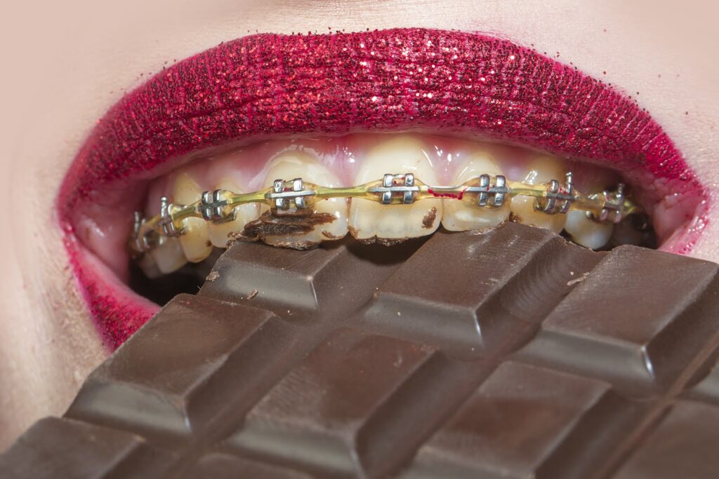 Foods to avoid with braces