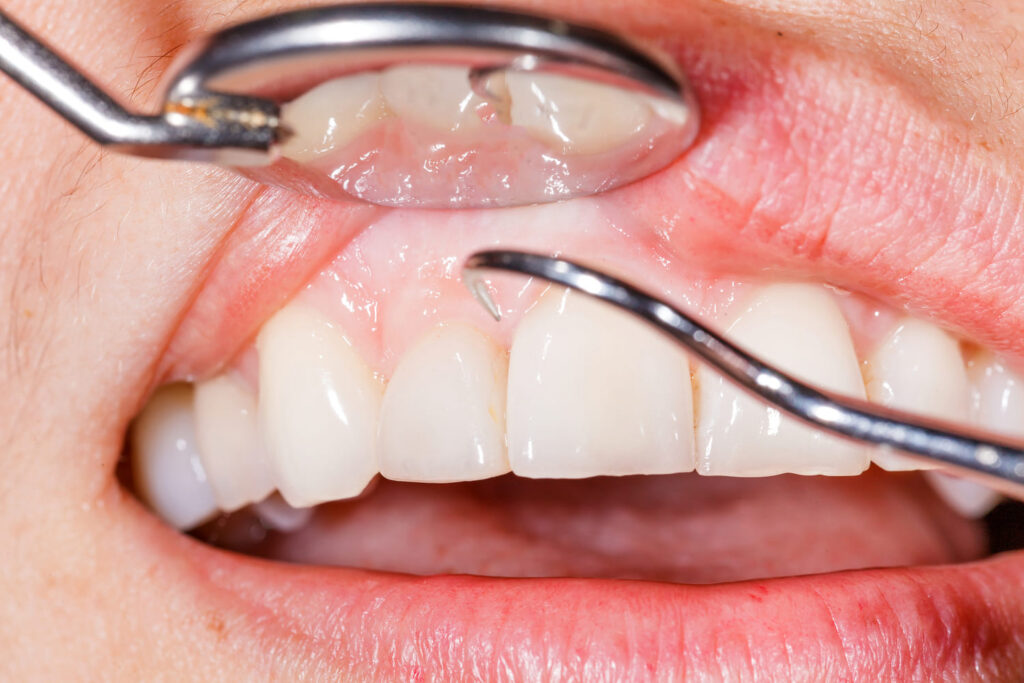 orthodontic consultation near Capitol Hill WA