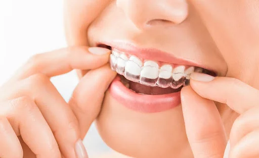 Woman learning Invisalign diet foods to eat and avoid